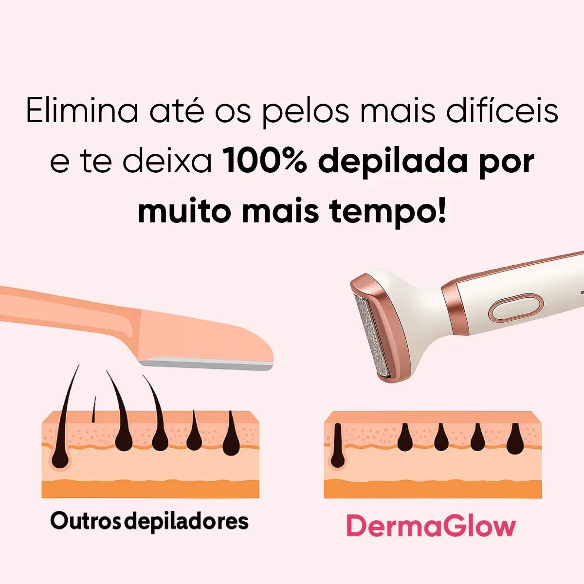 Depilador Elétrico 4 em 1 - DermaGlow